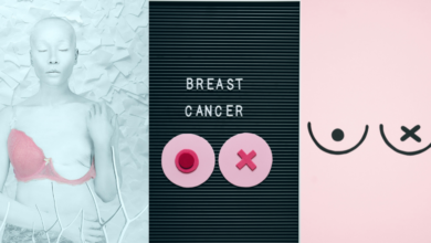 Breast Cancer