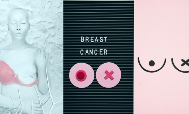 Breast Cancer